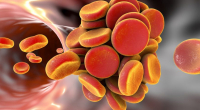 Lignes directrices CHEST mises à jour sur le traitement antithrombotique dans la thromboembolie veineuse